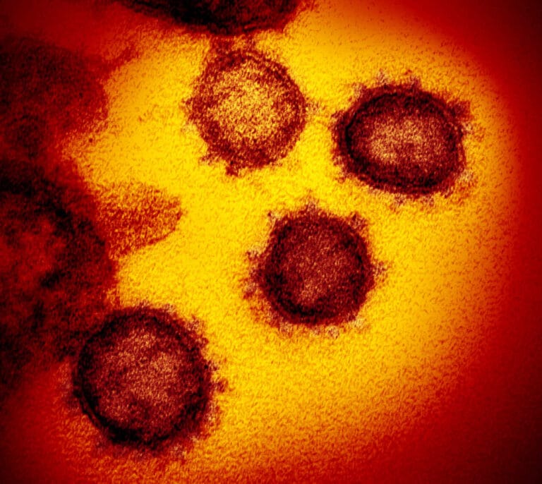 Detectan coronavirus en aguas residuales de Barcelona de marzo de 2019