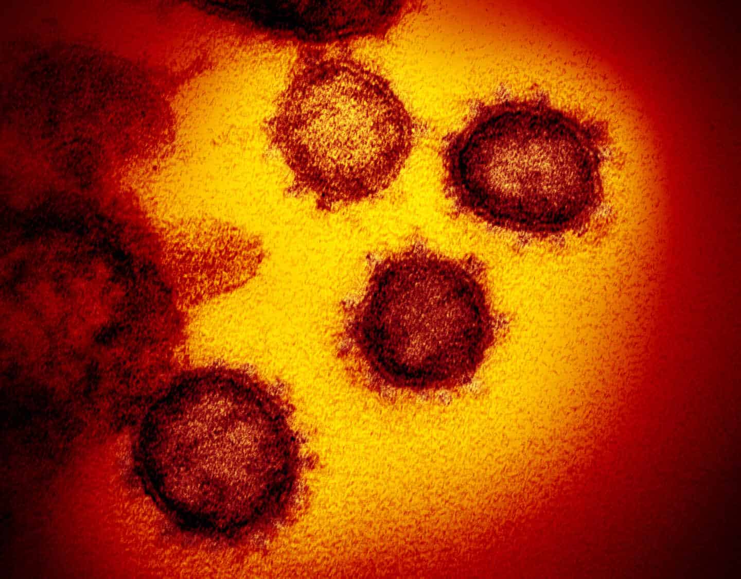 Rusia detecta "mutaciones" del coronavirus en Siberia y avisa de que podría generarse una nueva variante