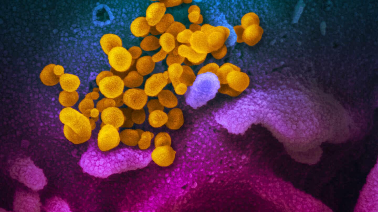 Seis preguntas clave sobre la nueva cepa de coronavirus descubierta en el Reino Unido