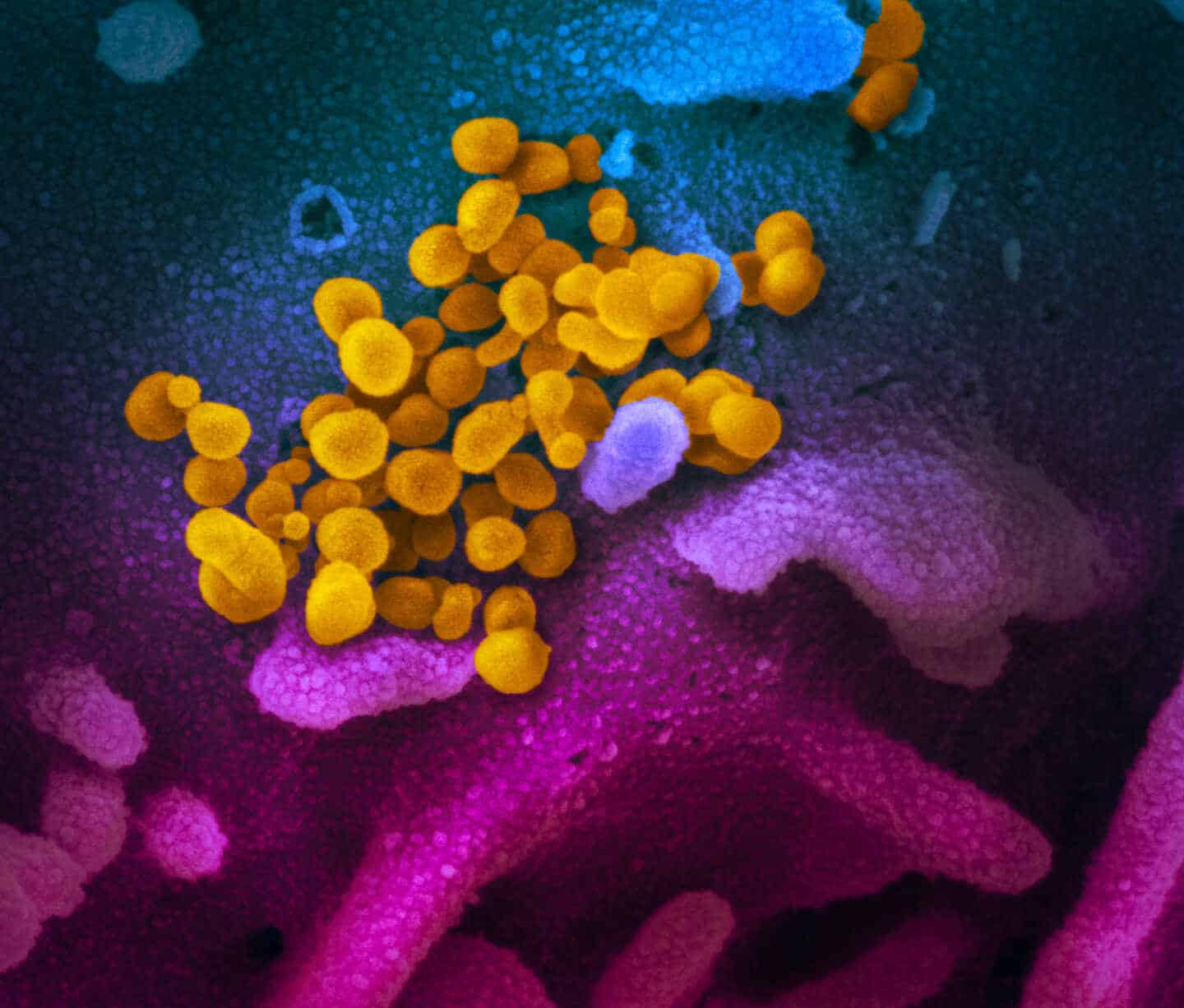 EEUU autoriza los ensayos con la primera prueba de antígenos del coronavirus, que da resultados en minutos