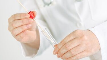 Hallan en una proteína de la saliva una posible clave para diagnosticar el Alzhéimer
