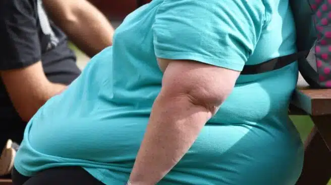 Por qué la obesidad, sin importar la edad, es un  factor de alto riesgo frente al COVID-19