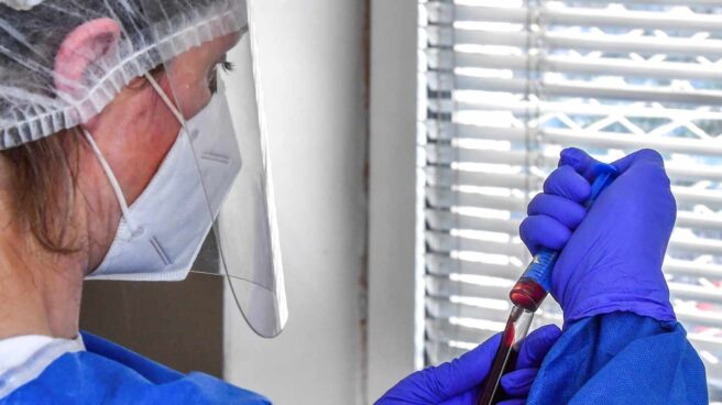Prueba de coronavirus.