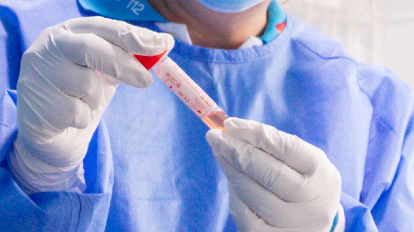 Un trabajador sanitario protegido sostiene una de las probetas utilizadas para la realización de tests PCR.