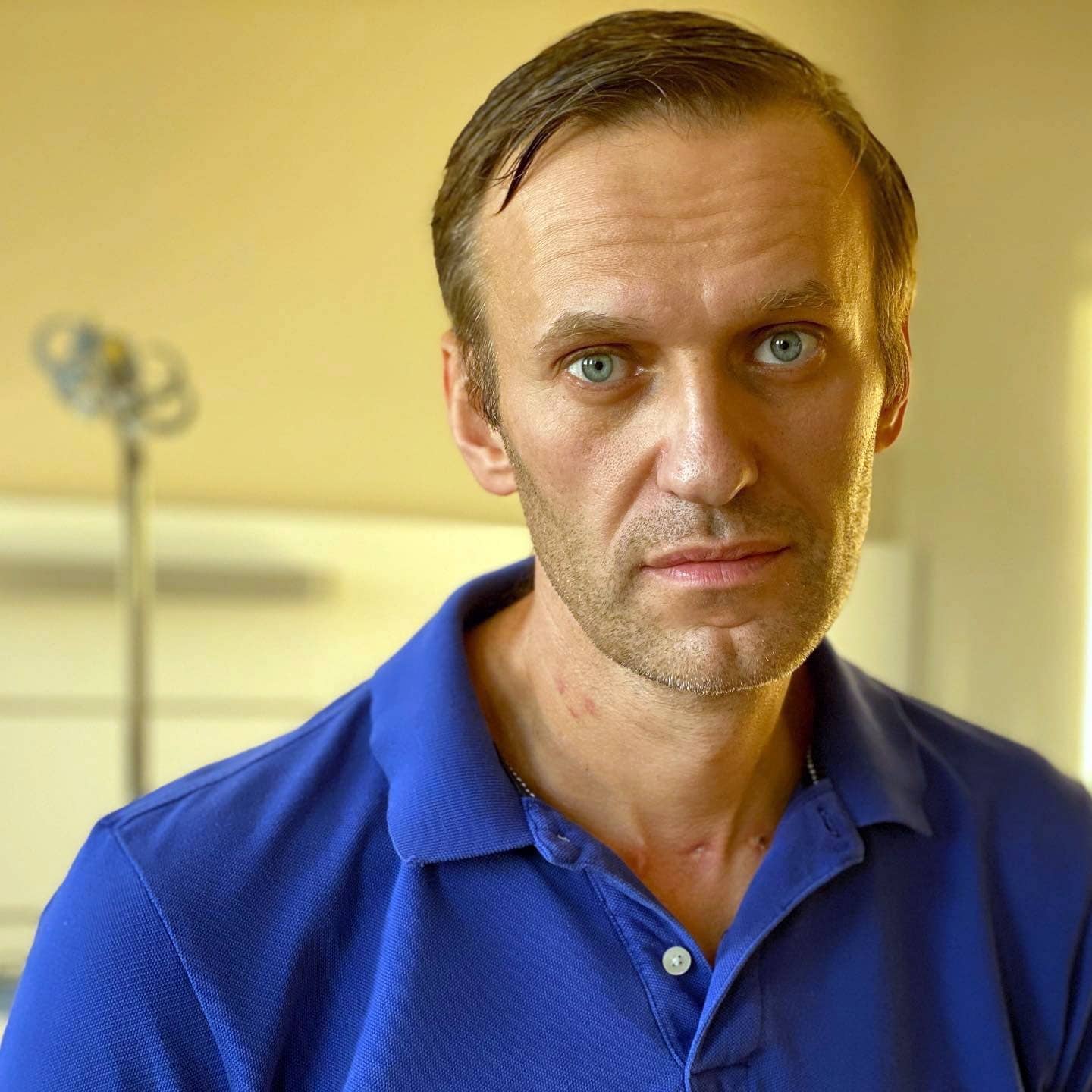 El opositor ruso Navalny recibe el alta hospitalaria