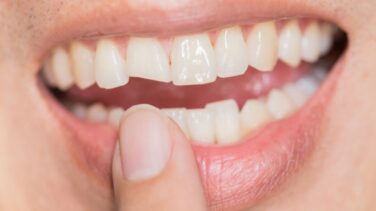 El Consejo General de Dentistas advierte de los riesgos del nuevo reto viral