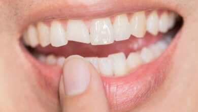 El Consejo General de Dentistas advierte de los riesgos del nuevo reto viral