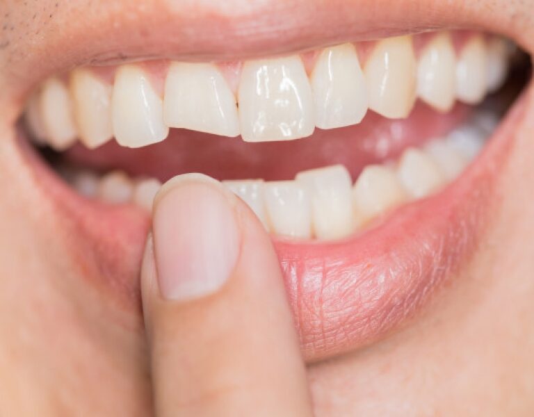 El Consejo General de Dentistas advierte de los riesgos del nuevo reto viral