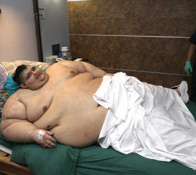 El que fuera el hombre más gordo del mundo supera el coronavirus