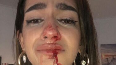 Los Mossos y la Fiscalía investigan una agresión transfóbica en Barcelona a una chica de 19 años