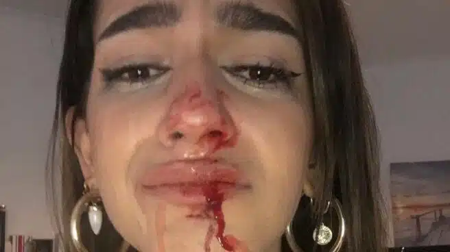 Los Mossos y la Fiscalía investigan una agresión transfóbica en Barcelona a una chica de 19 años