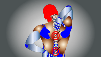 ¿Por qué las hernias discales pueden ser frecuentes entre deportistas?