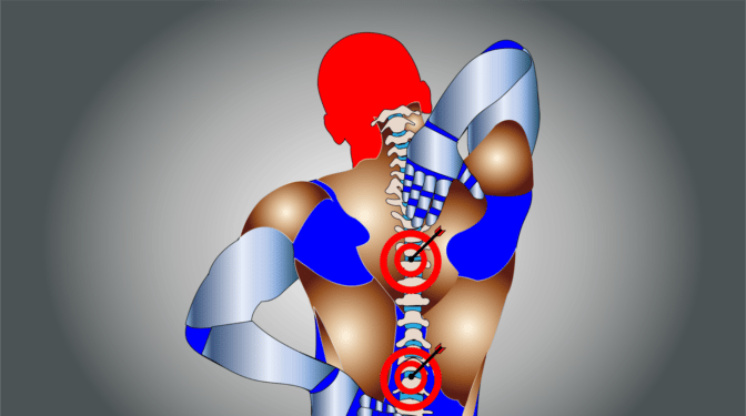 ¿Por qué las hernias discales pueden ser frecuentes entre deportistas?