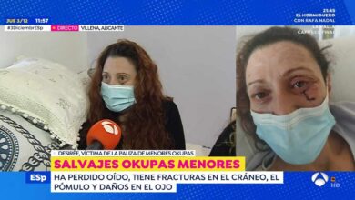 Tres okupas menores propinan una paliza a una mujer que termina con fracturas en el cráneo y un oído roto