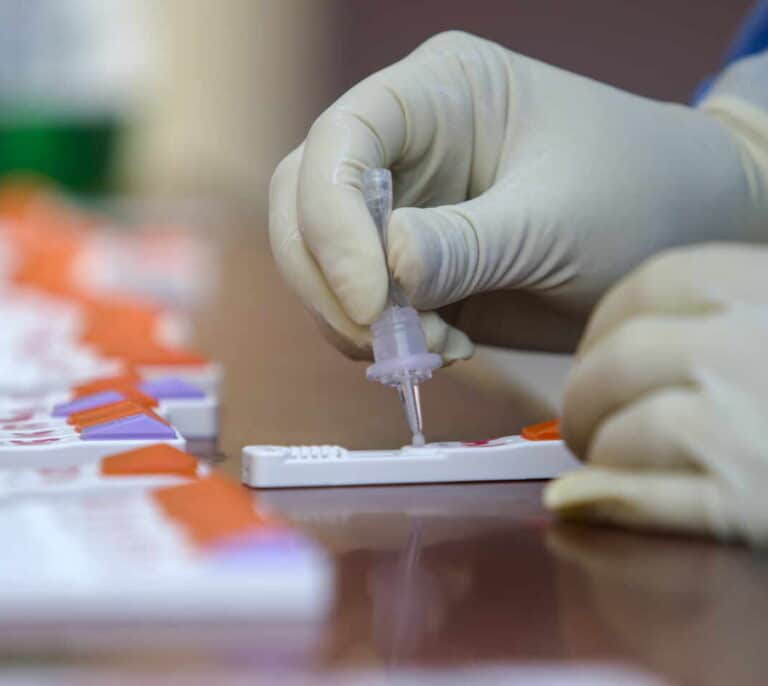 Madrid vuelve a pedir al Gobierno que las farmacias puedan realizar test de antígenos