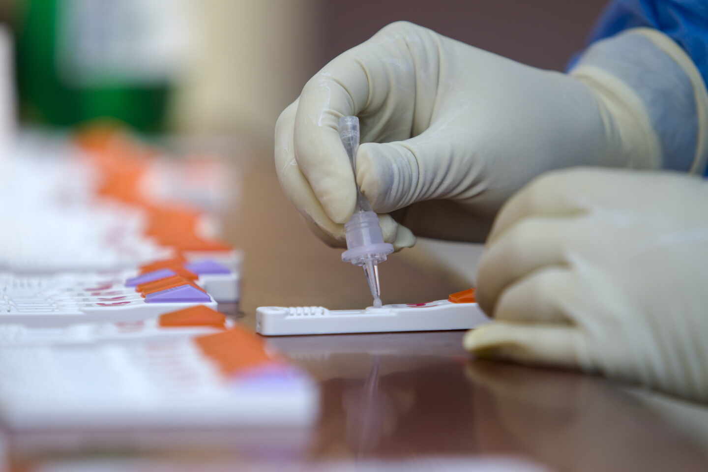 Madrid vuelve a pedir al Gobierno que las farmacias puedan realizar test de antígenos