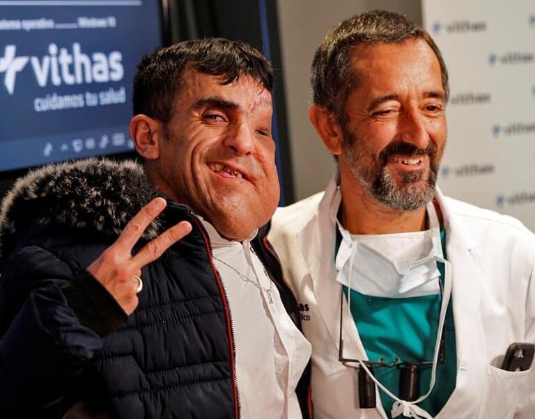 Ali, el joven al que el doctor Cavadas ha extirpado un tumor gigante en la cara: “Soy otra persona”
