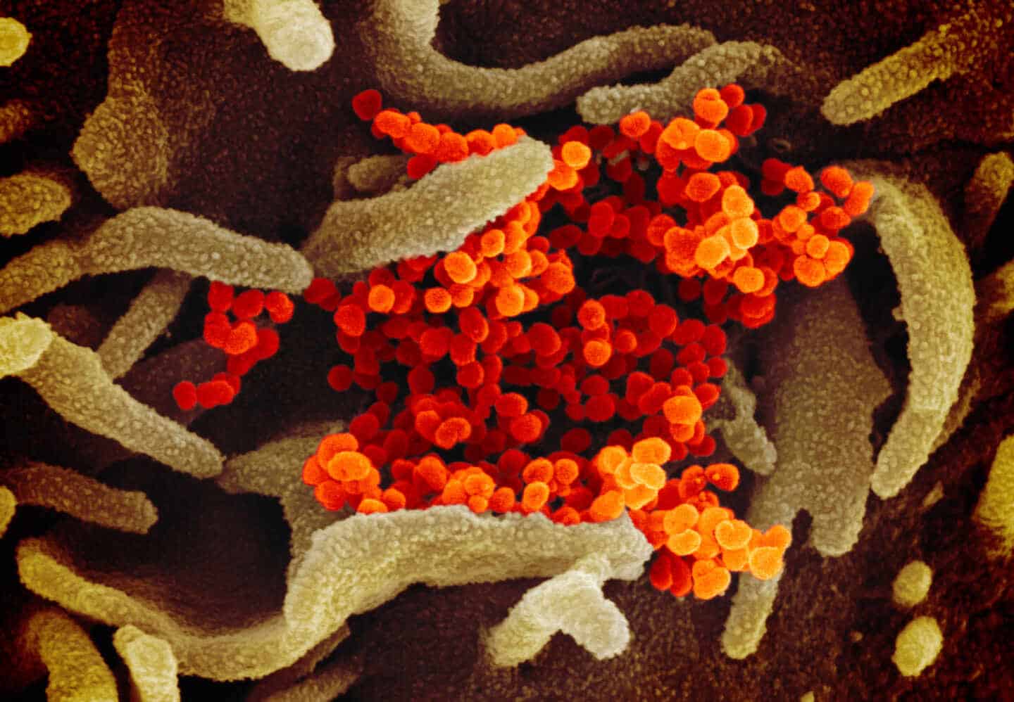 Imagen de laboratorio del virus SARS-CoV2
