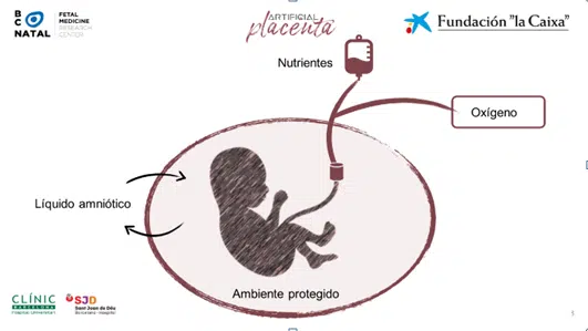 La Fundación La Caixa presenta el primer proyecto europeo de placenta artificial