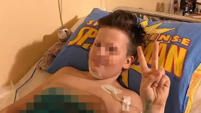 Amputan las piernas a un niño de 11 años tras un reto viral