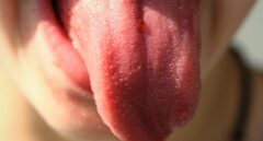Aumento de tamaño, zonas más lisas y pérdida del gusto: los efectos del Covid-19 en la lengua