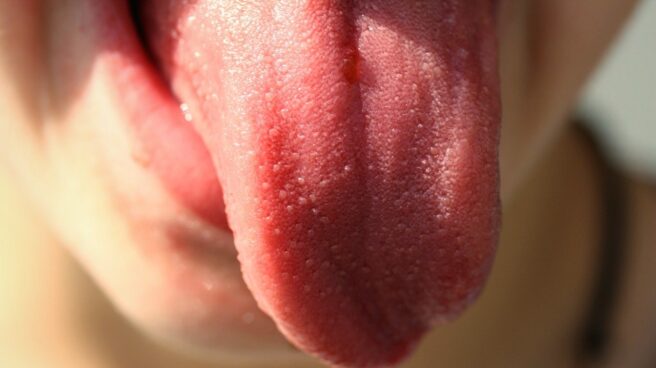 Lengua.