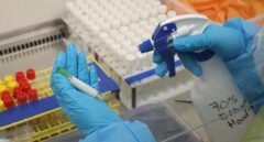 Majadahonda tendrá el primer laboratorio nivel 4 de España para trabajar con virus como el ébola