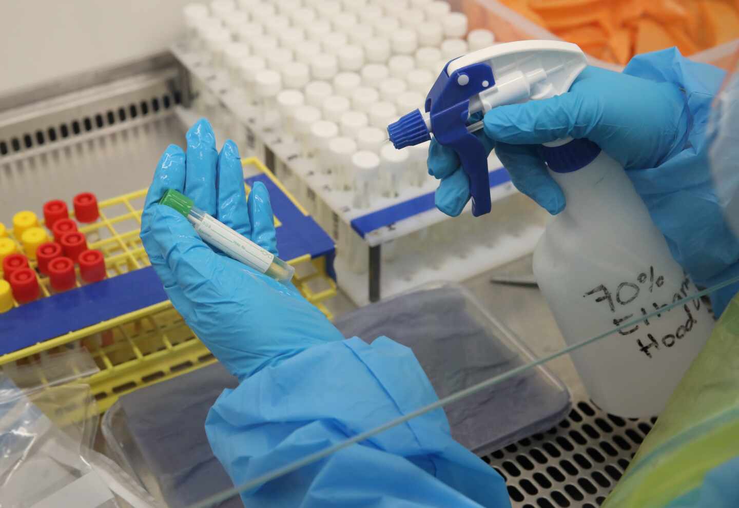 Majadahonda tendrá el primer laboratorio nivel 4 de España para trabajar con virus como el ébola
