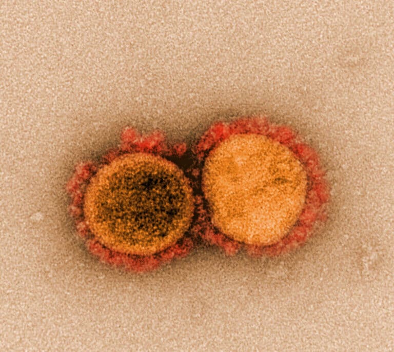 Un estudio demuestra que la variante británica es al menos un 30% más mortal