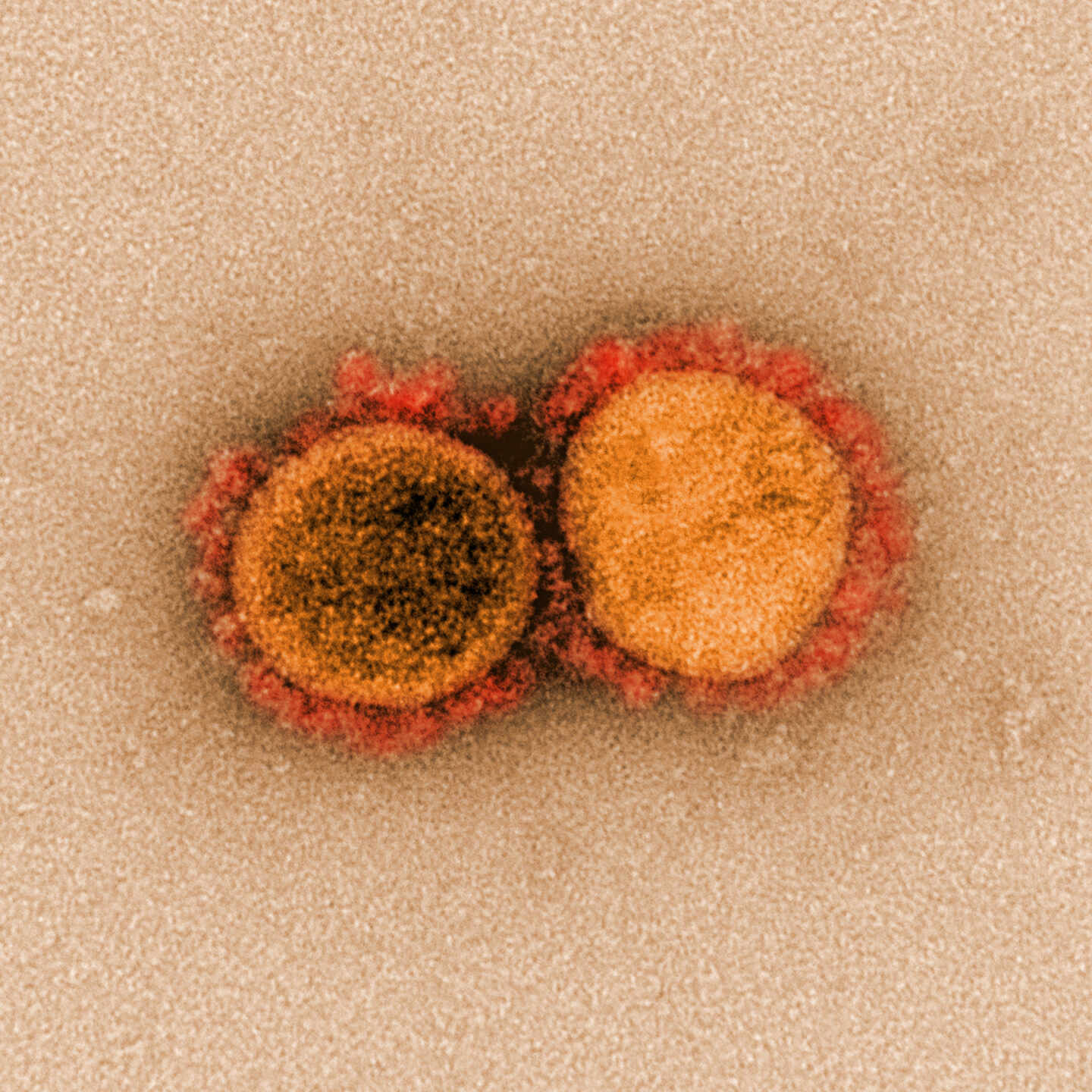 Imagen de microscopio de SARS-COV-2