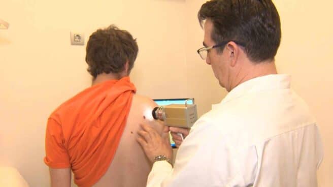 PRUEBAS PARA DETECTAR EL CÁNCER DE PIEL Un médico analiza la piel de un paciente.