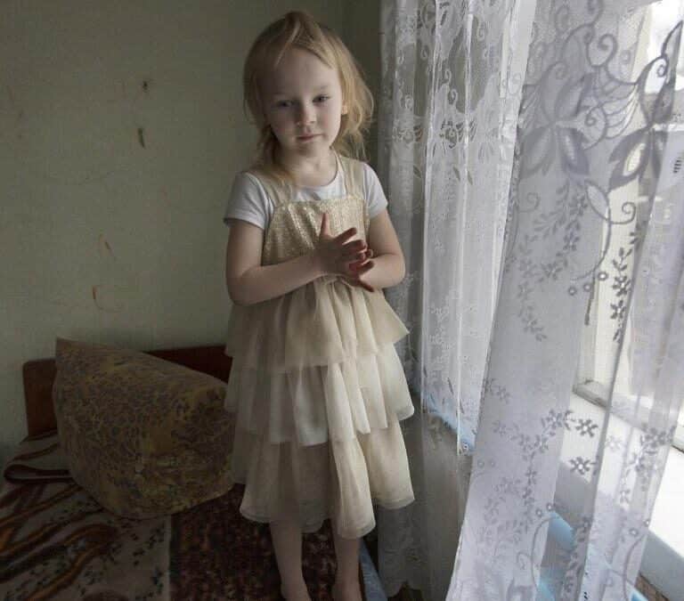 'Vida después de Chernobyl', la exposición del olvido y los efectos de la radiación