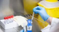 Qué se sabe de la variante Ómicron, hallada en Sudáfrica, con un "alto número de mutaciones"
