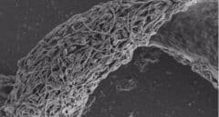 Micrografía electrónica de barrido de espermatozoides humanos pegados e inmovilizados por un anticuerpo antiespermático.