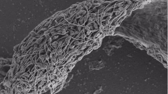Micrografía electrónica de barrido de espermatozoides humanos pegados e inmovilizados por un anticuerpo antiespermático.
