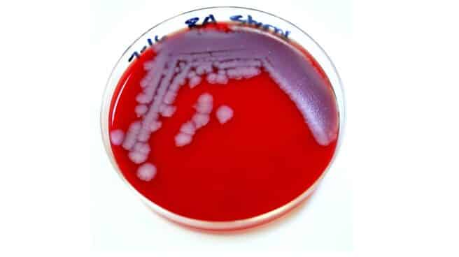 Bacilus anthracis, la bacteria causante de la enfermedad del ántrax o carbunco.