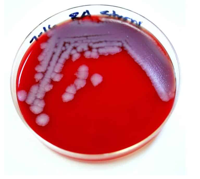 Qué es el ántrax y cómo se contagia