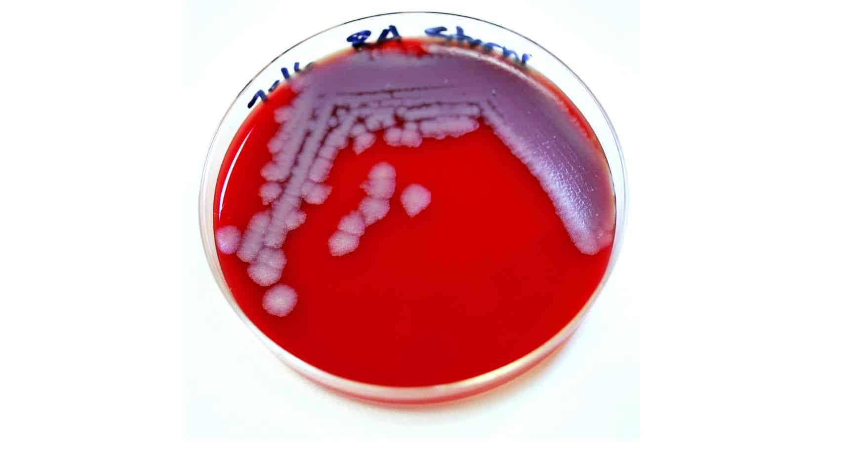 Bacilus anthracis, la bacteria causante de la enfermedad del ántrax o carbunco.