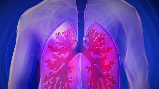 Día Internacional de la Fibrosis Quística: ¿En qué consiste la enfermedad? Día Mundial de la Fibrosis Quística