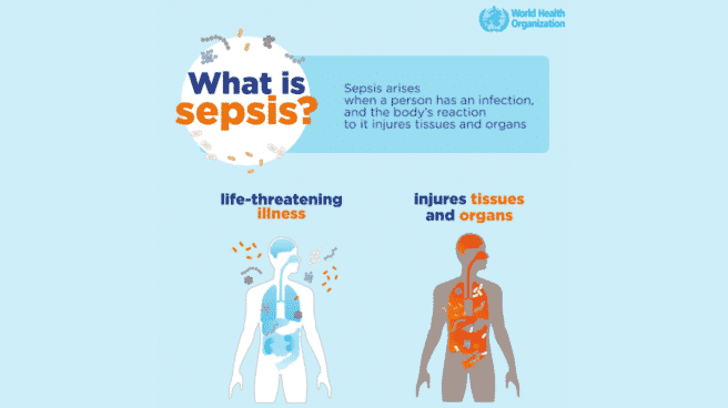Día Mundial de la Sepsis: ¿en qué consiste esta enfermedad? Cartel informativo sobre la sepsis
