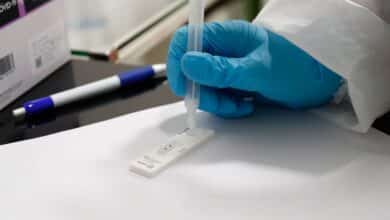 Madrid regalará un test de antígenos en farmacias para la Navidad