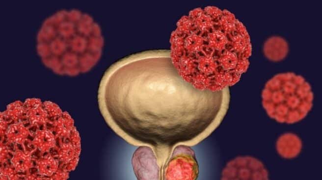 Cuatro hábitos imprescindibles ante el cáncer de próstata y de testículos dentro y fuera de la consulta Cáncer de próstata