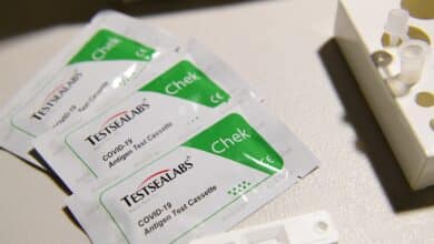 Los test de antígenos gratuitos en farmacias de Madrid llegan el miércoles