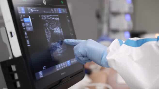 pacientes-covid pacientes-covid-uci-ingreso-madrid