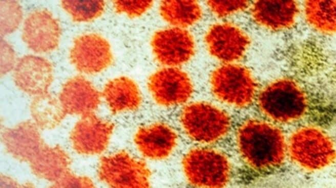 Imagen microscópica de la hepatitis A