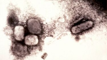Este es el protocolo para el virus del mono que ha fijado Sanidad ante el aumento de casos