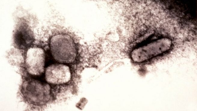 Este es el protocolo para el virus del mono que ha fijado Sanidad ante el aumento de casos