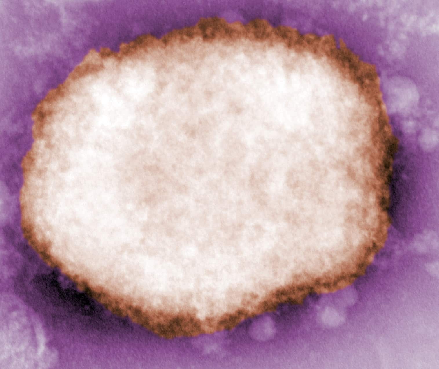 Imagen del virus de la viruela del mono.