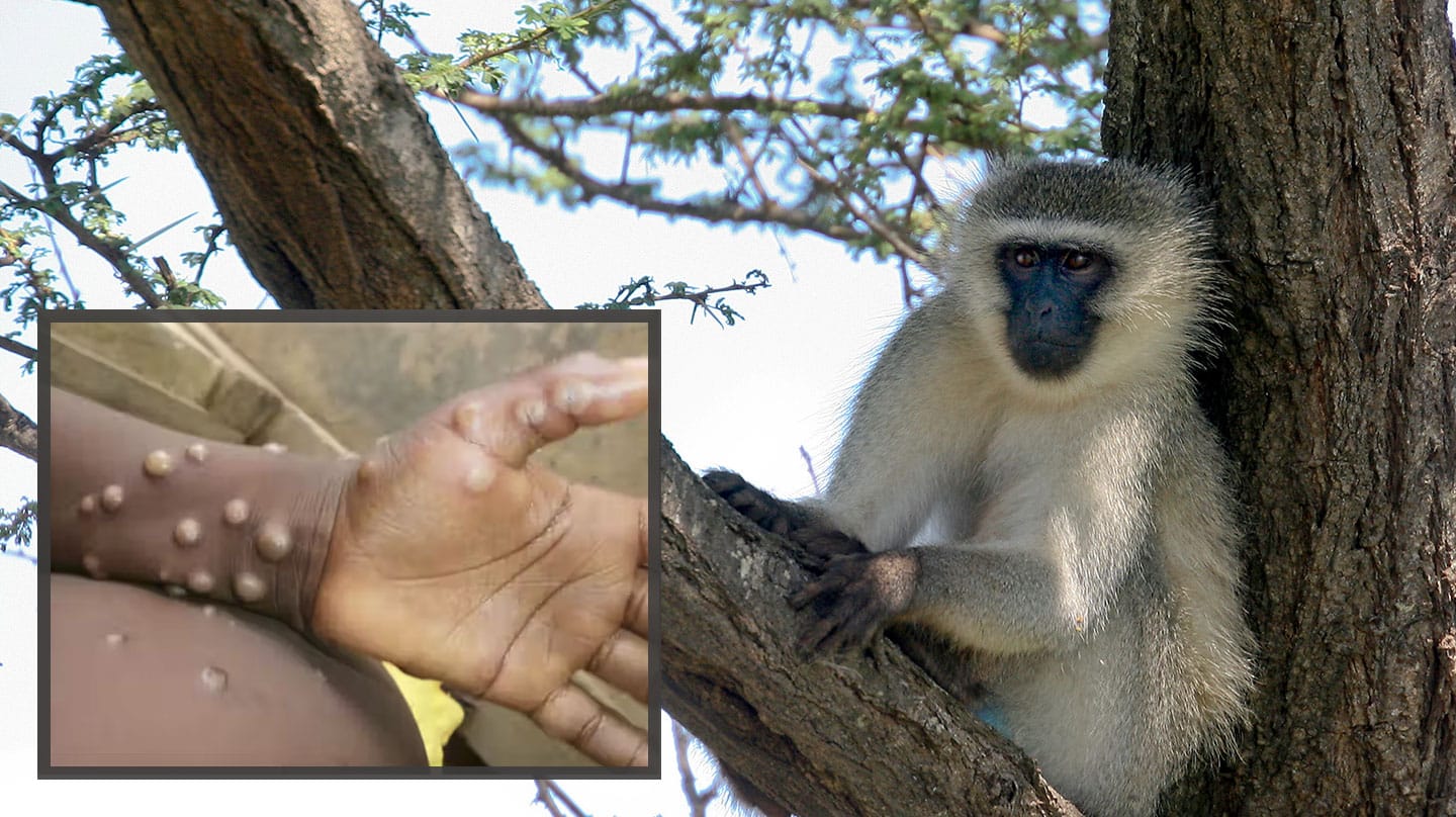 Imagen de un mono africano con un detalle de la enfermedad de Viruela del mono