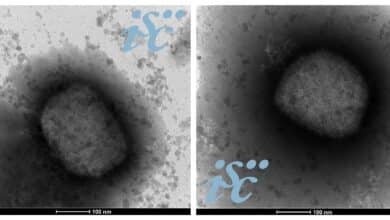 El Instituto Carlos III logra la secuencia completa del virus del mono, cuyo numero de contagios lidera España